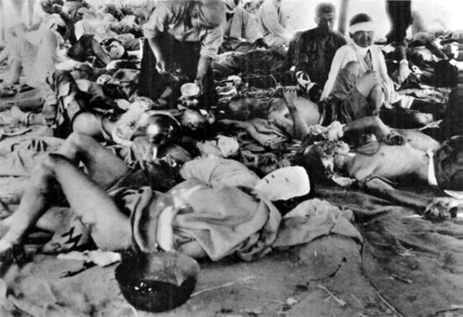 Жертвы атомной бомбардировки. 1945 г.