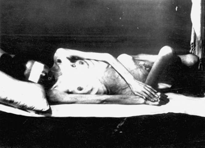 Нацистам необходимо было создать эффективный способ стерилизации. Предпочтительным считалось радиационное облучение. Заключенных приводили в комнату для заполнения анкеты в течение 2–3 минут. В это время они подвергались радиационному облучению, в результате чего становились полностью бесплодны.